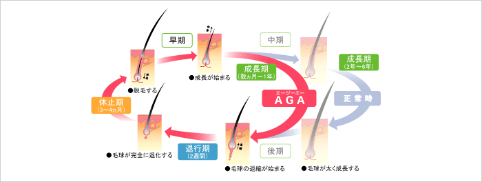 薄毛になってしまうヘアサイクルのしくみ