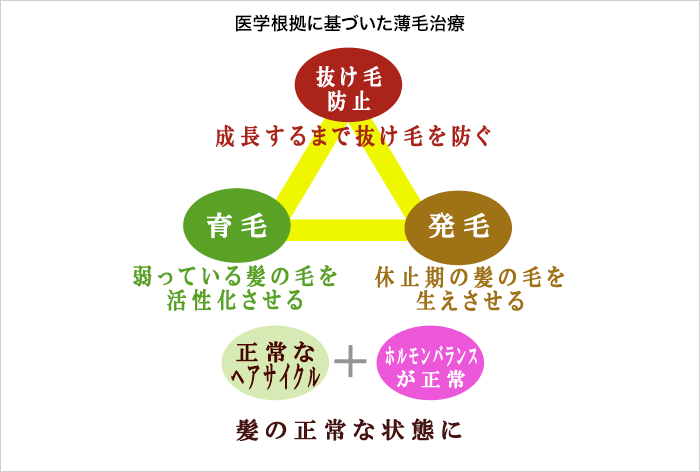 男性AGA治療のポイント